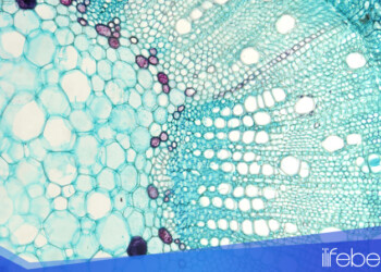 Un microscopio en tu smartphone: La Inteligencia Artificial lo hace posible